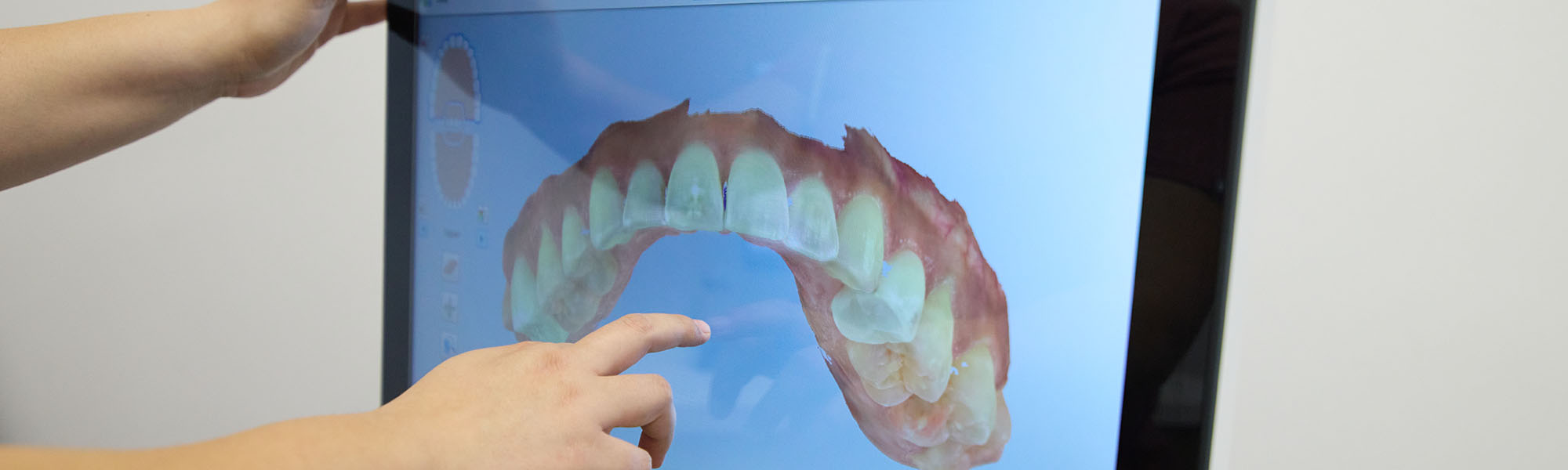 3D Dental Imaging Anaheim CA