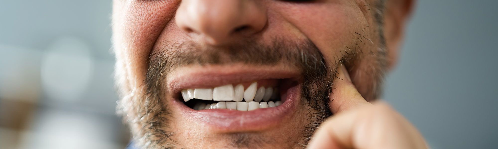 Periodontal Disease Anaheim CA